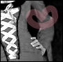 myspace layouts, myspace codes, glitter graphics